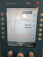 Neuromonitoring Neuromonitoring