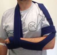 Proximaler Oberarmbruch2 Proximaler Oberarmbruch2