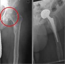 Oberschenkel 4 Oberschenkel 4