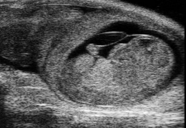 Mausembryo am Tag 13 Mausembryo am Tag 13